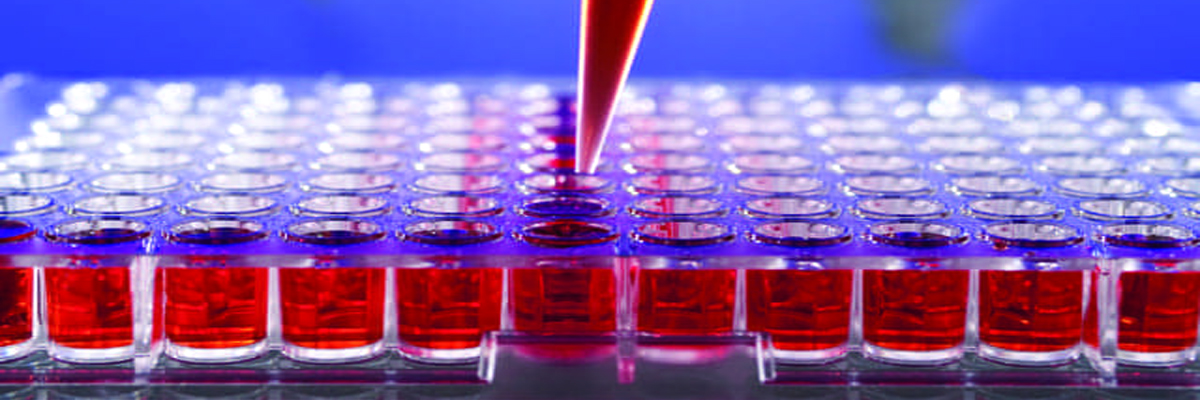 The Vital Role of Immunoassay Analyzers in Modern Diagnostics
